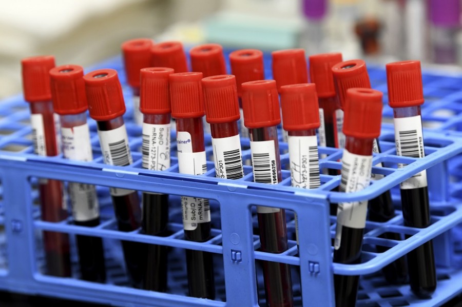 Científicos buscan evidencias de la pandemia en viejas muestras de sangre. Foto AP/Taimy Alvarez